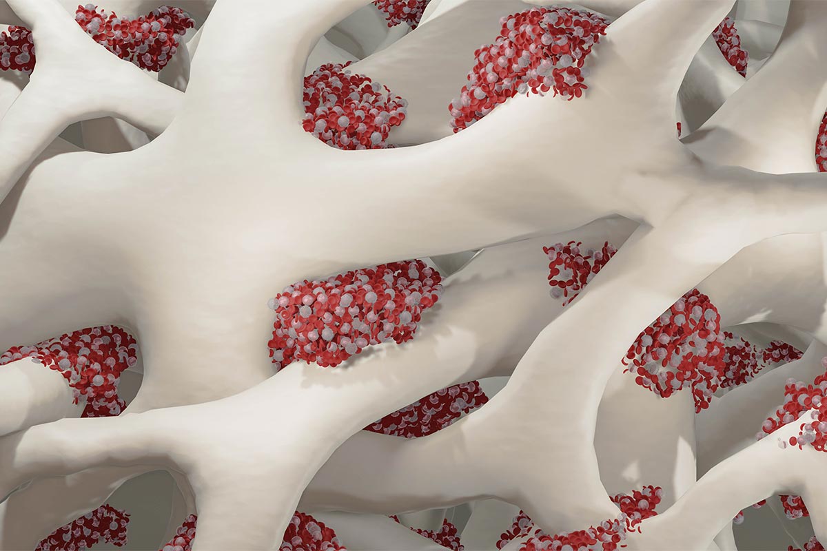 upclose illustration of bone marrow