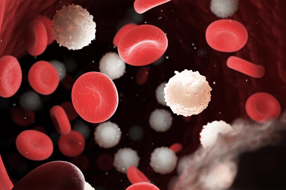 3d rendered medically accurate illustration of too many white blood cells due to leukemia