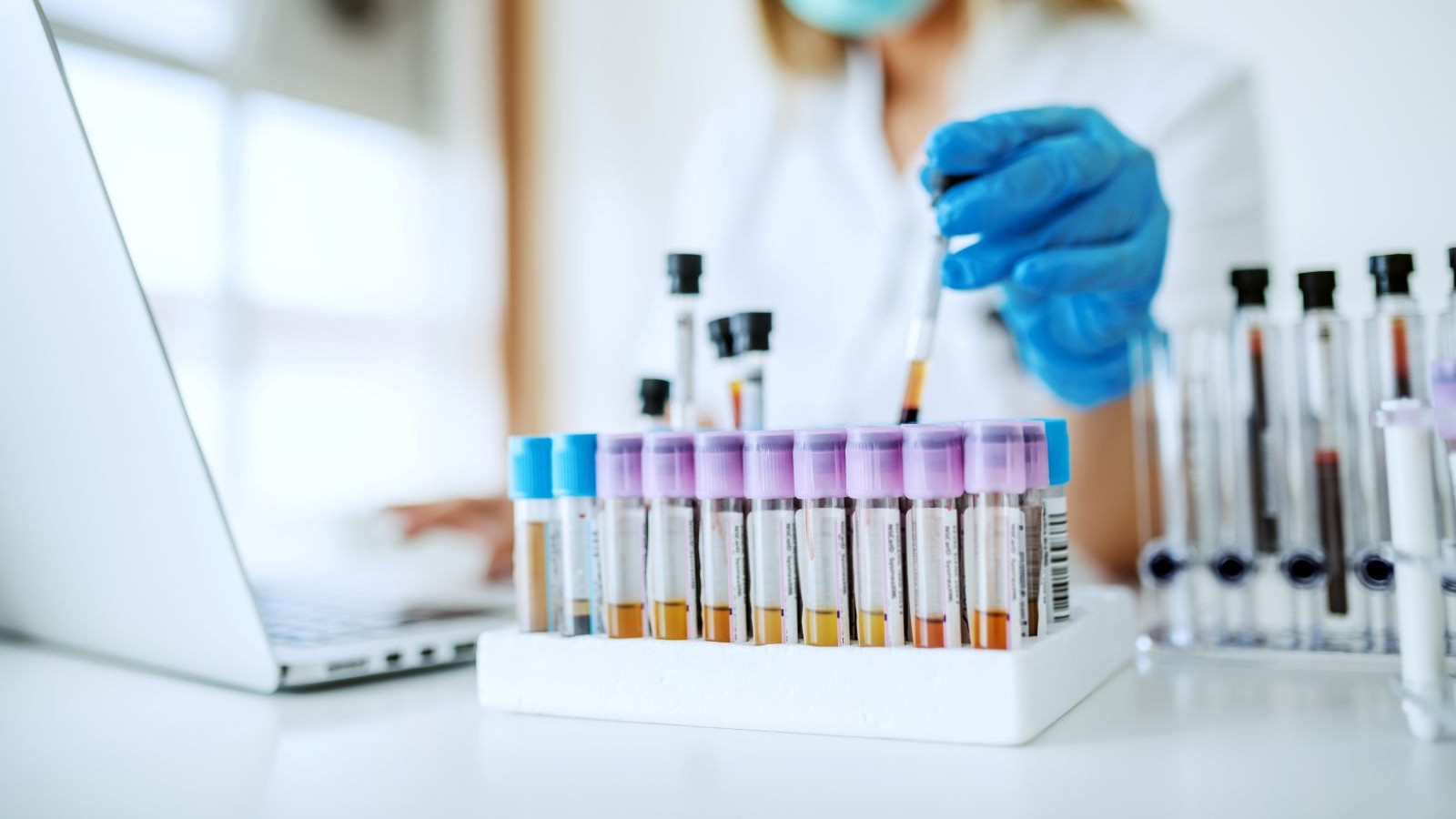 Close up of lab assistant in uniform, with mask and rubber gloves holding test tube with blood sample while sitting on chair and typing on laptop.